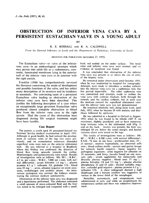 PDF extract preview