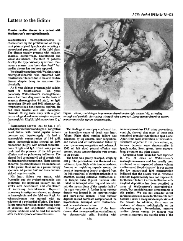 PDF extract preview