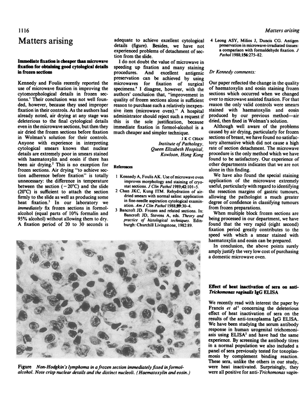 PDF extract preview
