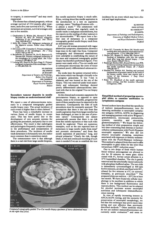 PDF extract preview