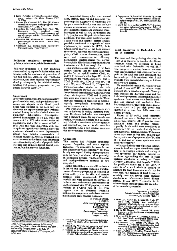 PDF extract preview