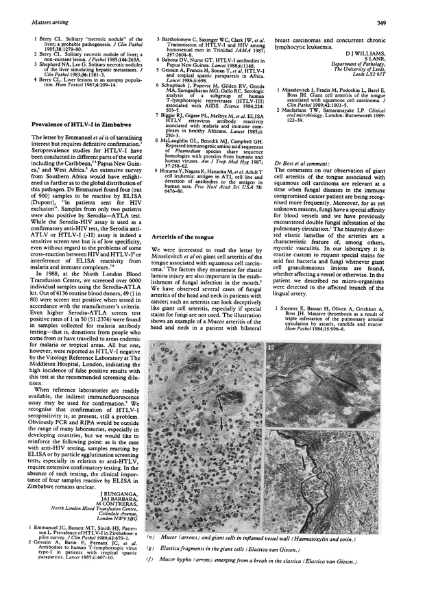 PDF extract preview