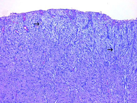   Figure 14 