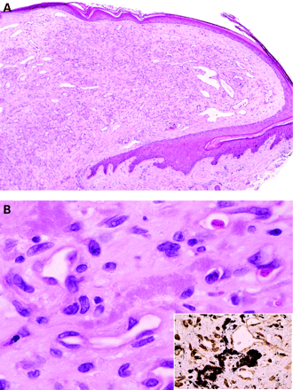 Figure 21