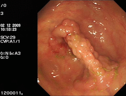 Figure 5