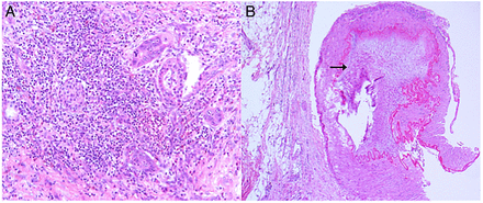 Figure 11