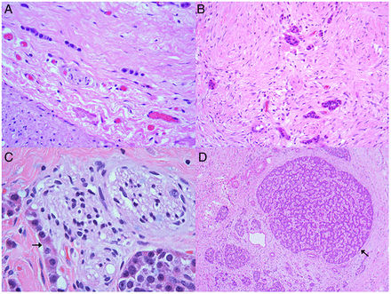 Figure 12