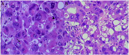 Figure 9