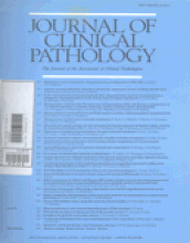 Journal of Clinical Pathology: 43 (5)