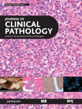 Journal of Clinical Pathology: 68 (5)