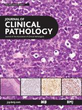 Journal of Clinical Pathology: 69 (5)