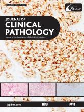 Journal of Clinical Pathology: 75 (1)