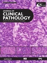 Journal of Clinical Pathology: 75 (11)